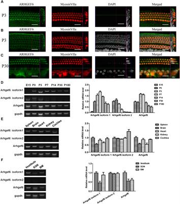 Loss of ARHGEF6 Causes Hair Cell Stereocilia Deficits and Hearing Loss in Mice